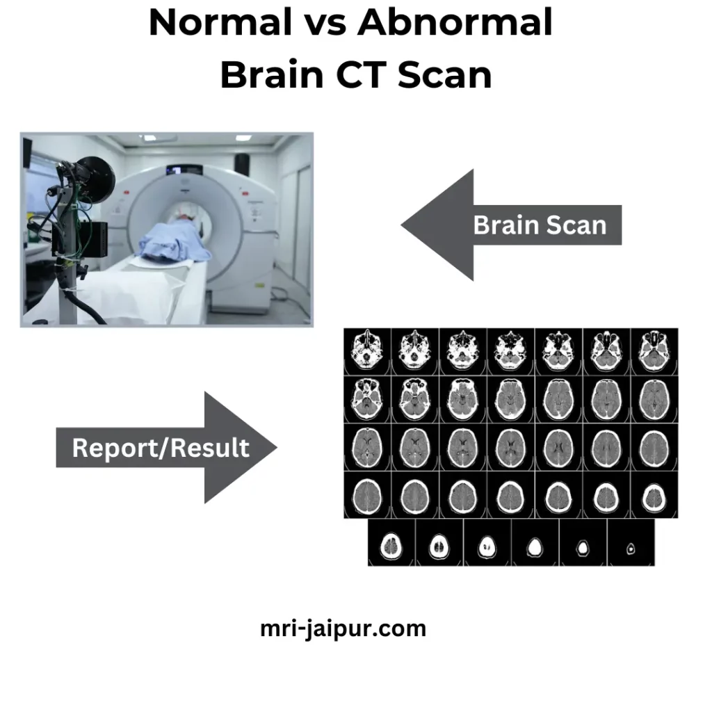 Normal vs Abnormal Brain CT Scan