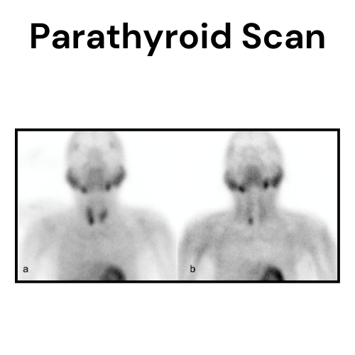 Parathyroid Scan