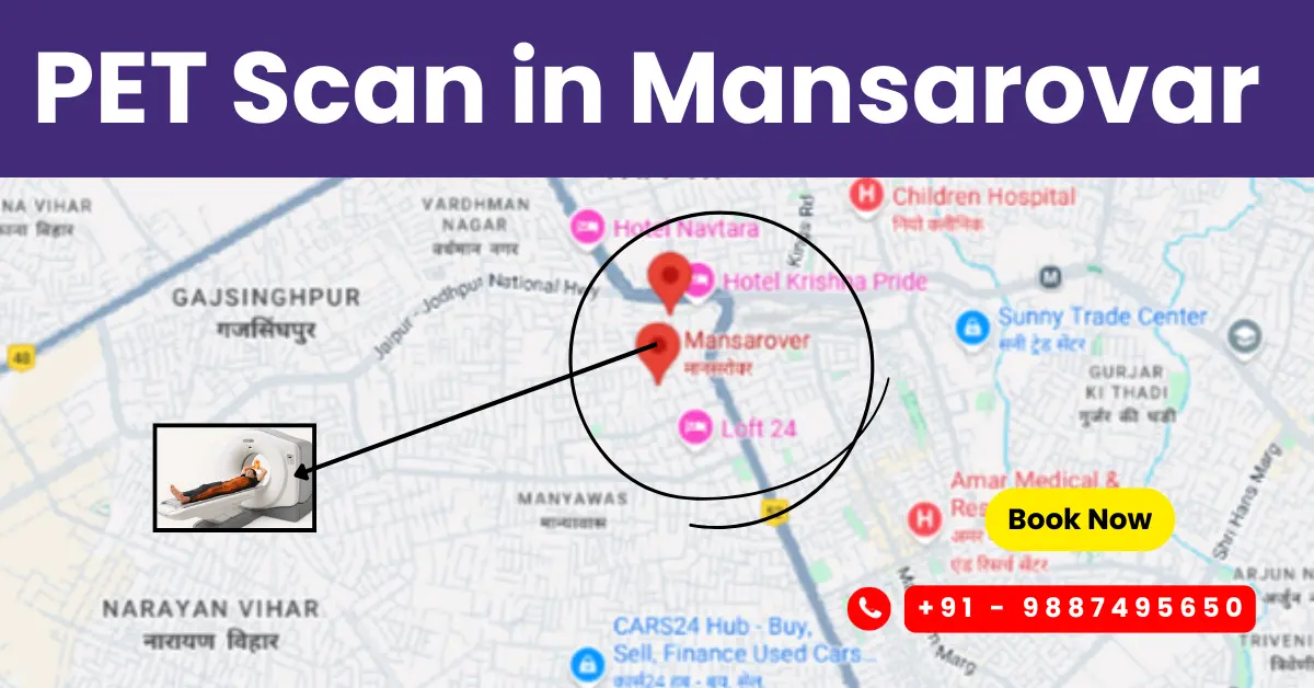 Pet Scan Cost In Mansarovar Jaipur