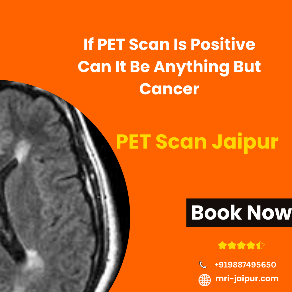 PET Scan Jaipur