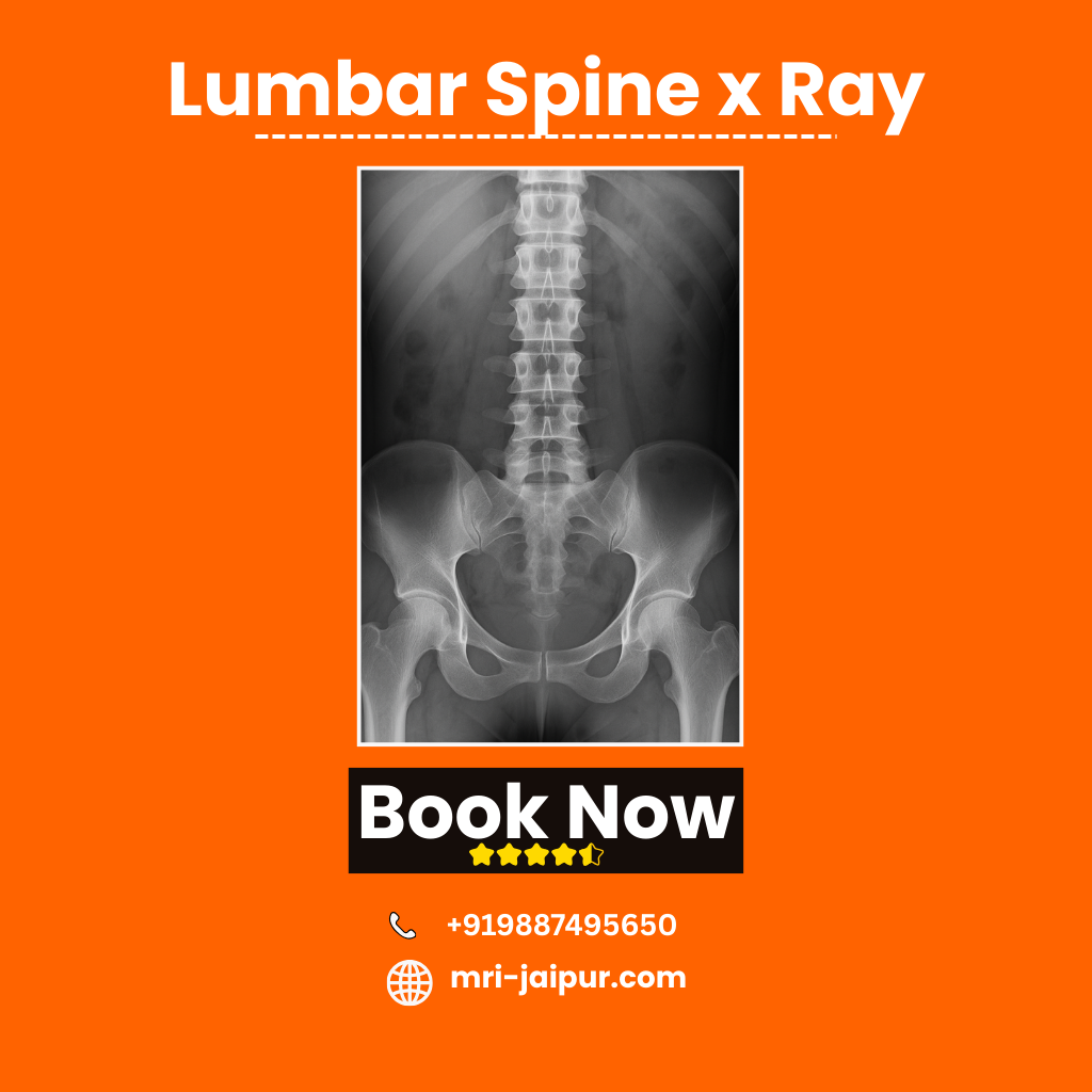 Lumbar Spine x Ray In Jaipur – Cost, Report